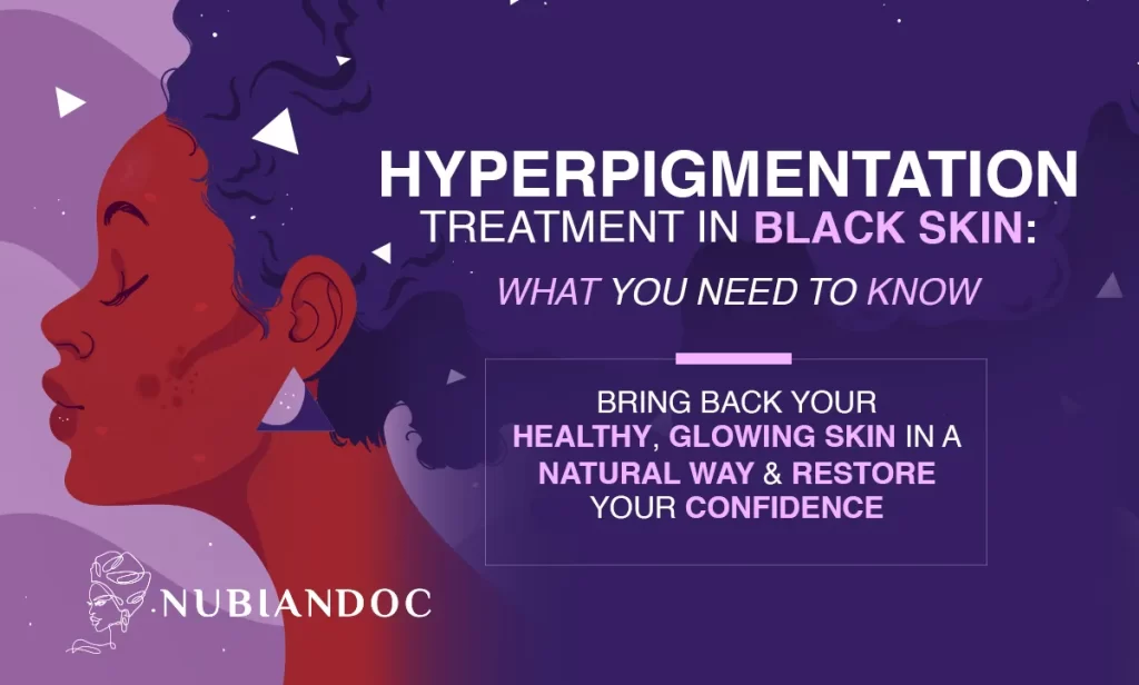 Hyperpigmentation Treatment: How to Get Rid of Dark Spots?