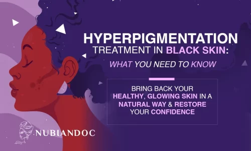 Hyperpigmentation Treatment: How to Get Rid of Dark Spots?