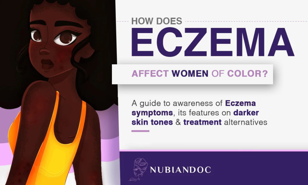 Eczema In Dark Skinned Women What You Need To Know