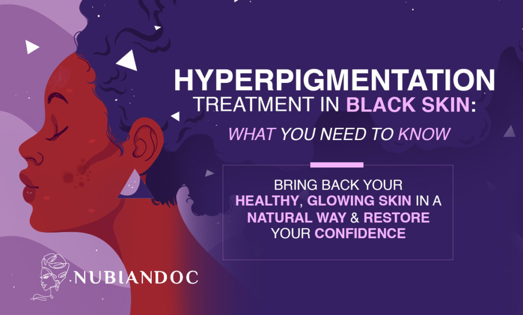 Hyperpigmentation Treatment: How to Get Rid of Dark Spots?
